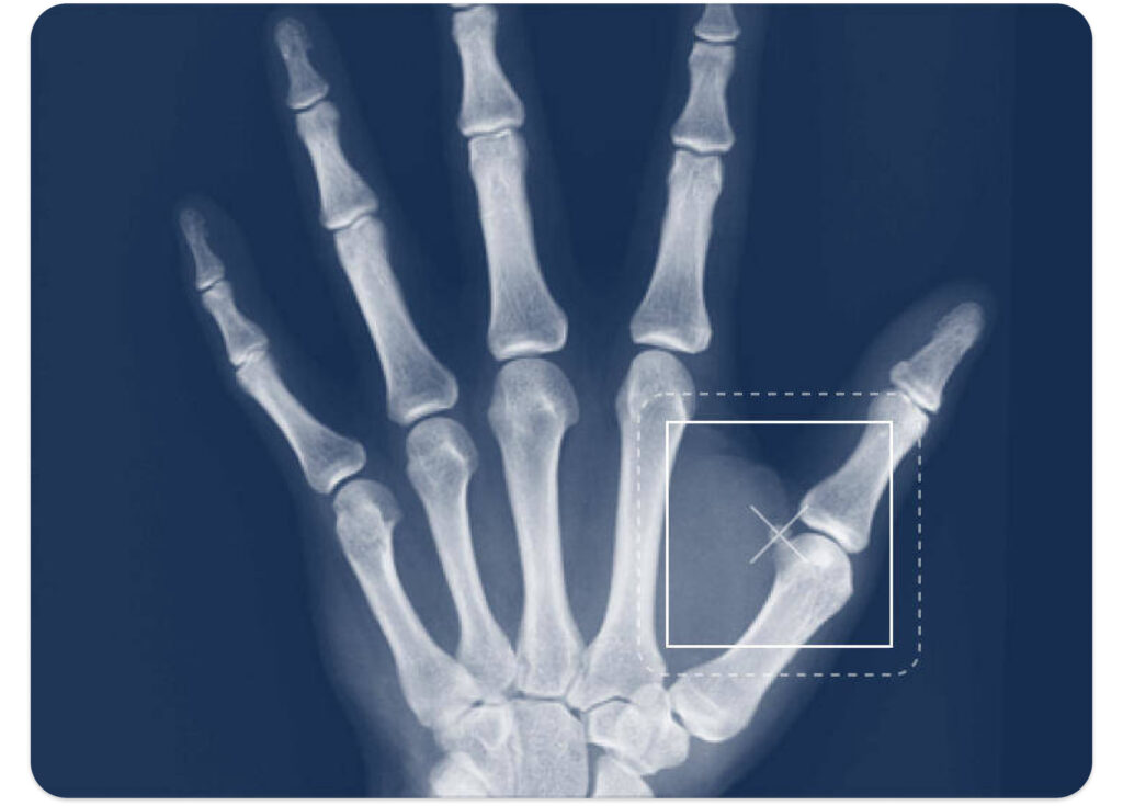 Advanced visual AI systems can automatically identify and segment-specific objects within images, such as detecting a tumour in a medical scan or isolating a particular cell type in a biopsy.